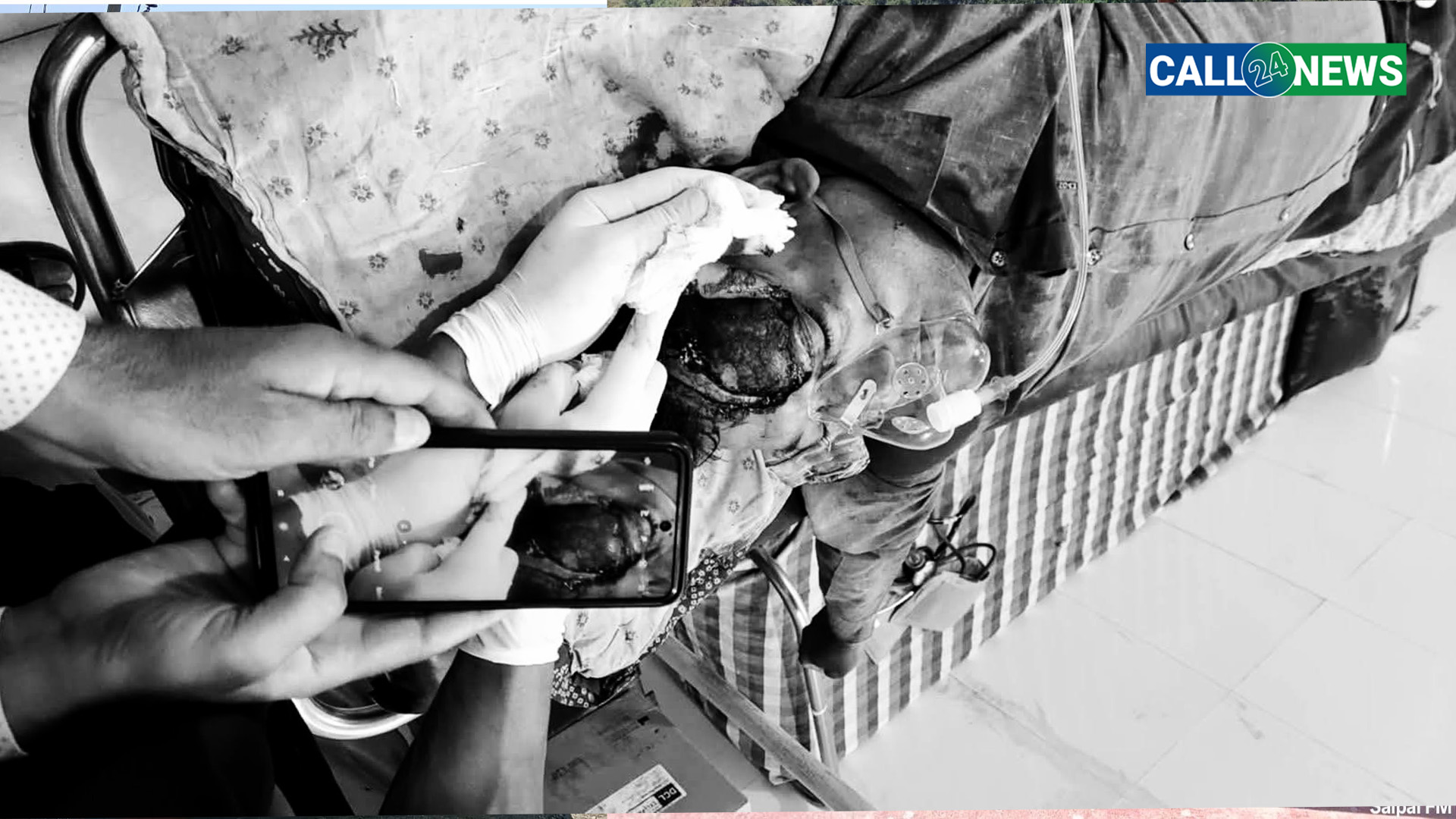 कैलालीमा एक्कासी हावाहुरी , रुख भाँचिदा राष्ट्रिय कलेजका पूर्व क्याम्पस प्रमुख भण्डारी घाइते