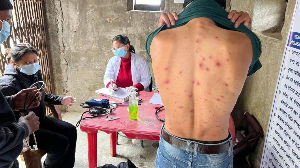 बैतडीको ठेउला प्रभावित क्षेत्रमा पुग्यो विश्व स्वास्थ्य संगठनको टोली