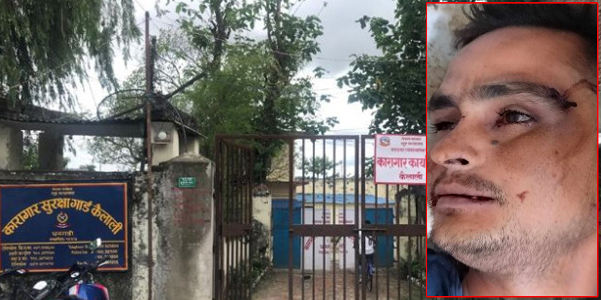 कैदी मृत्यु प्रकरणः सीआईबीको टोली धनगढीमा