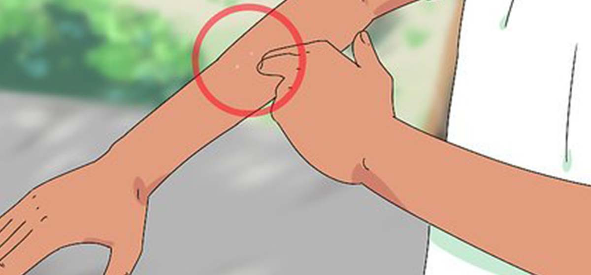 महिनावारी हुँदा गोठमा सुत्न जाँदा सर्पको टोकाइबाट मृत्यु