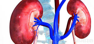 एउटै समूहले ५ नेपालीको मिर्गौला निकालेको खुलासा, नाइके पक्राउ