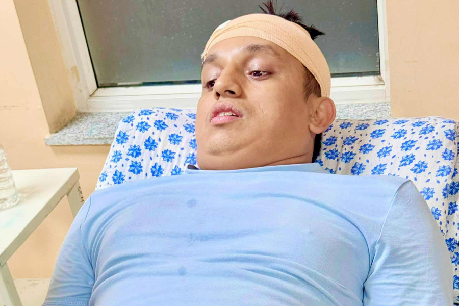 रास्वपा नेता भण्डारीमाथि आक्रमण