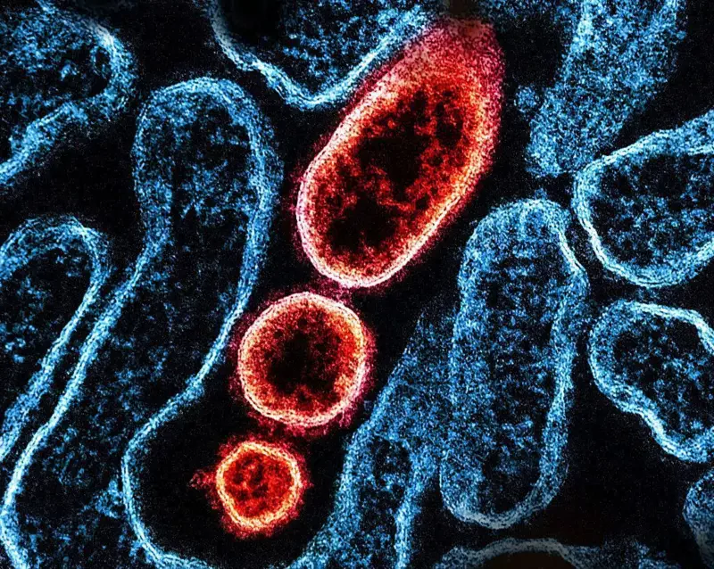 निपा भाइसरबाट जोगिन के गर्दैछ सरकार ?